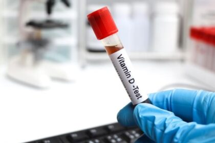 Nova lei no rio inclui vitamina d em exames de rotina