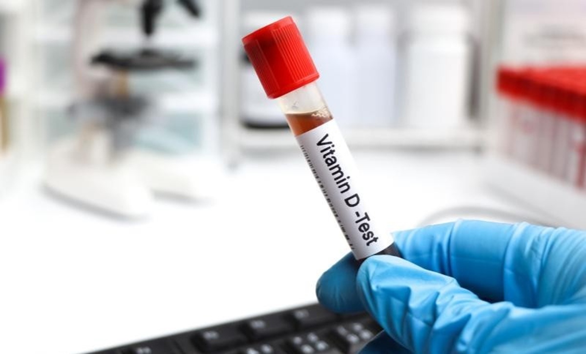 Nova lei no rio inclui vitamina d em exames de rotina