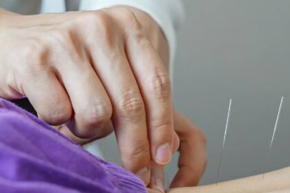 Brasil regulamenta acupuntura: nova lei define padrões para prática profissional