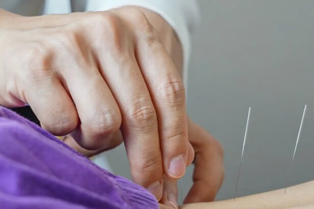 Brasil regulamenta acupuntura: nova lei define padrões para prática profissional